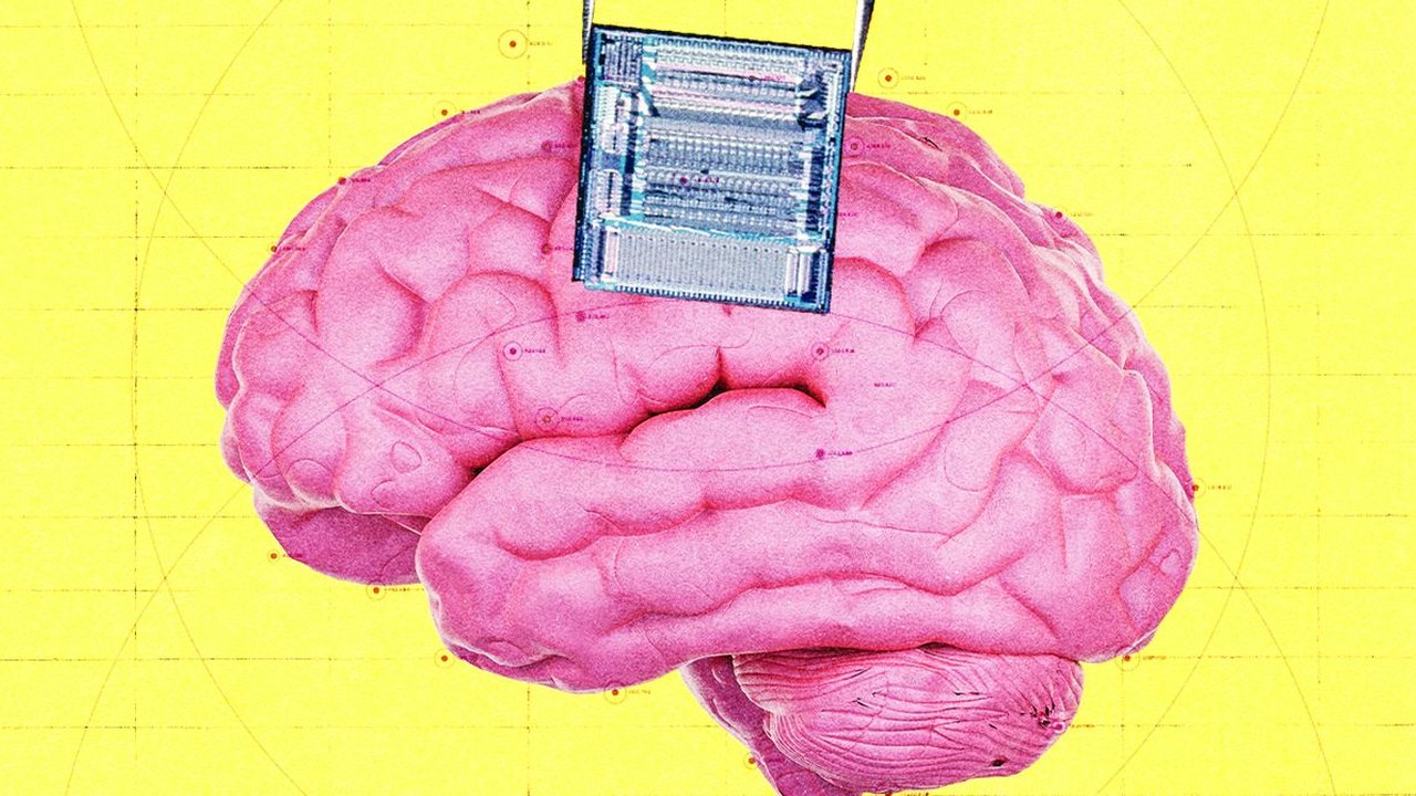 OpenAI का वेंचर आर्म ब्रेन इम्प्लांट के जरिए कैंसर का पता लगाने वाले स्टार्टअप में कर रहा है निवेश